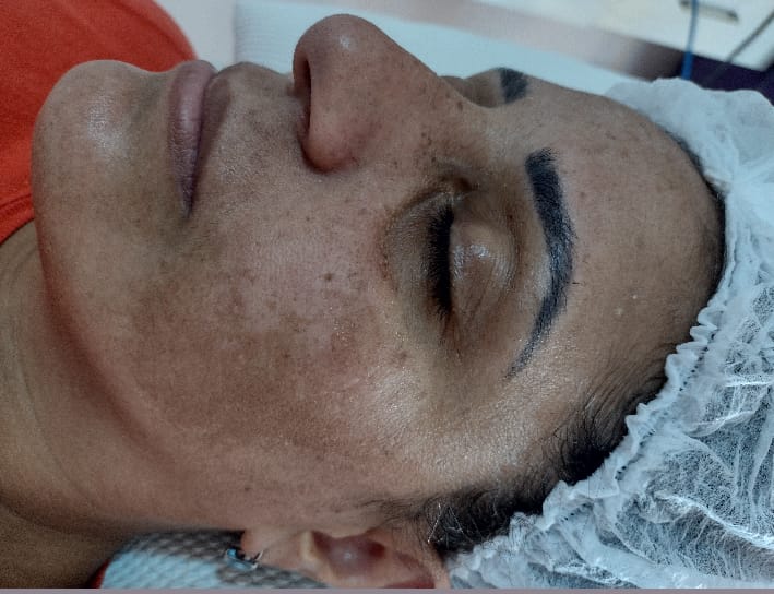 Estética facial · Bella Pele Depilação — salão de beleza em Icaraí, Niterói - RJ