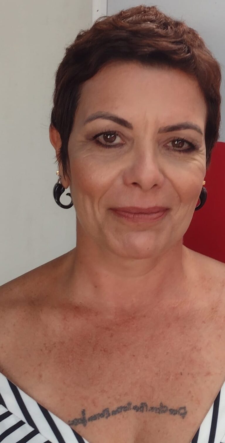Antes e depois · Bella Pele Depilação — salão de beleza em Icaraí, Niterói - RJ